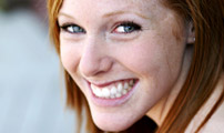Veneers